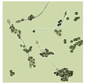 BRED-011 کیت تست باروری زن برای تعیین اسپرماتوزا تشخیص ناباروری مردانه