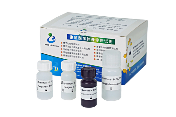 آزمایش قطعه بندی DNA اسپرم، سنجش ساختار کروماتین اسپرم SCSA