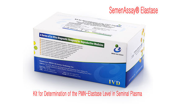 کیت تست تجزیه DNA اسپرم اقتصادی برای تعیین سطح تکه تکه شدن DNA - روش پراکندگی اسپرم کروماتین