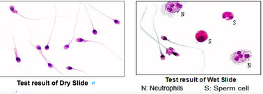آزمایش مورفولوژی سلول های خونی اسلایدهای رنگ آمیزی شده از قبل