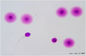 Economical Sperm DNA Fragmentation Test Kit For DNA Fragmentation Level Determination--sperm chromatin dispersion method